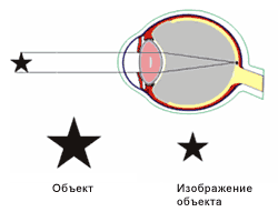 Устраняем близорукость