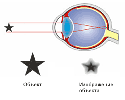 Устраняем близорукость