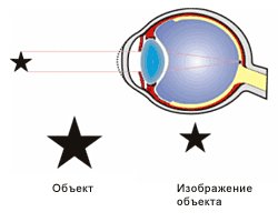 Устраняем близорукость